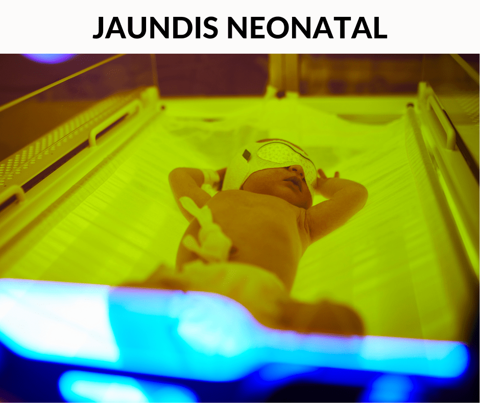 Jaundis Neonatal